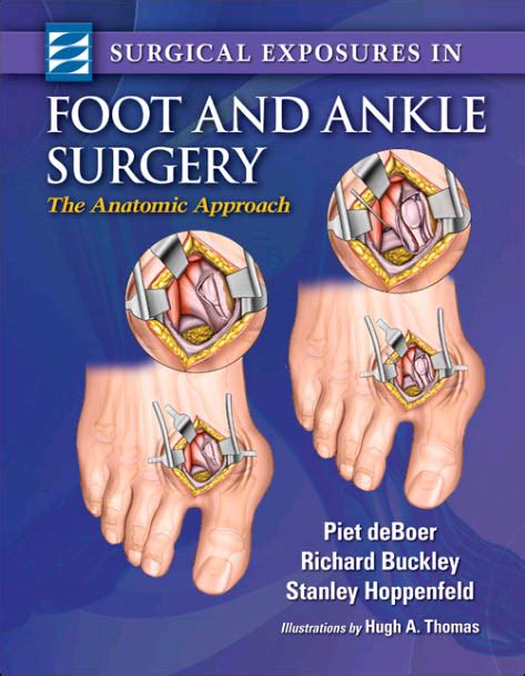 surgical exposures in foot and ankle surgery the anatomic approach Reader